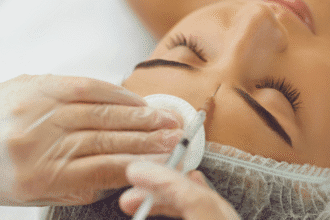 Mi az a Relfydess Botox